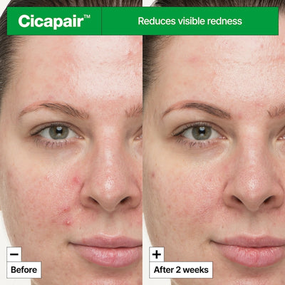 DR JART CICAPAIR SO SOOTHING TREATMENT 30ML