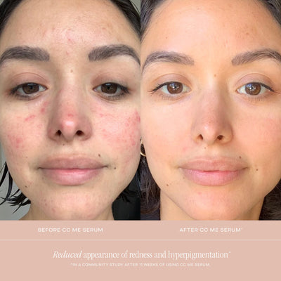 SUMMER FRIDAYS CC ME SERUM® WITH VITAMIN C + NIACINAMIDE